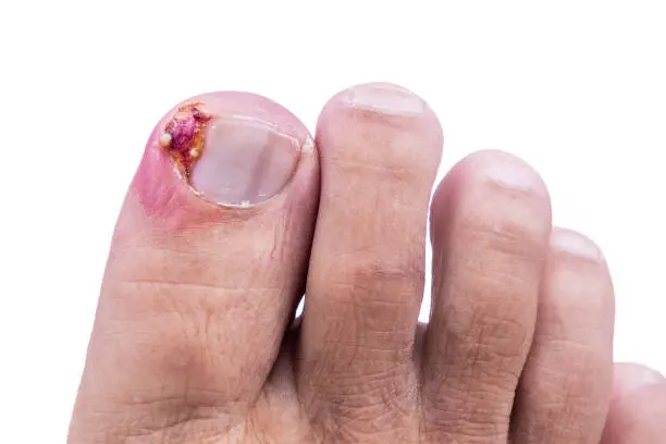 istockphoto 1267337771 612x612 1